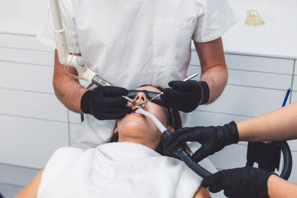 Teeth Whitening in LA